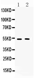WB - Anti-CHRM2 Picoband Antibody ABO10256
